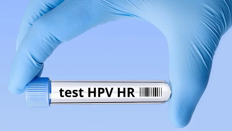 Nowe zasady w programie profilaktyki raka szyjki macicy: test HPV HR zamiast cytologii
